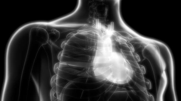 Amarin Dives on Surprise FDA Heart-Drug Review