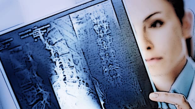 HIV, Syphilis-Cluster Affects at Least 125 People in Milwaukee