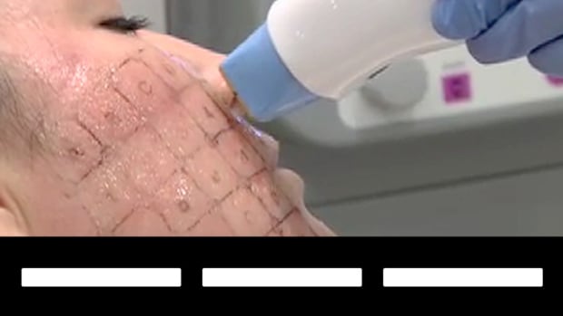 Fat-Burning Still Hot In Slow Economy, Says Solta CEO