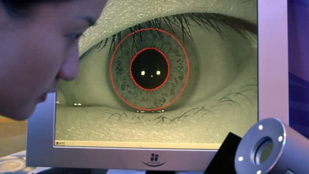 Inotek Pharma Glaucoma Drug Suffers Study Setback at Start of New Year