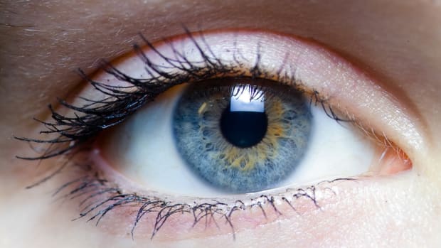 Iridex Eyes BRICs To Laser Ahead