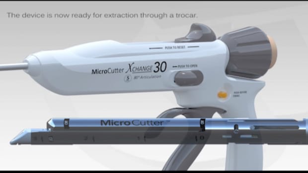 Cardica CEO: Japan Just Right