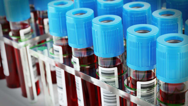 Bioverativ Makes Splash in Trading Debut, Gaining 18% on Day One