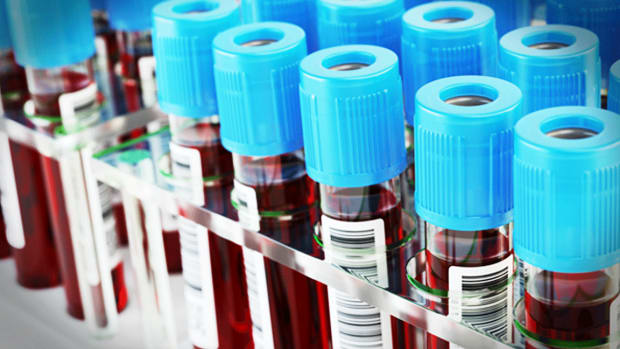 A Technical Strategy for Tandem Diabetes Care