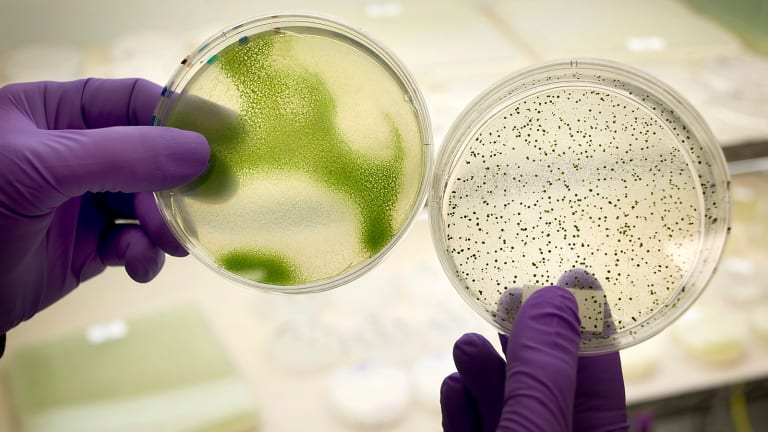 Why Intercept Pharmaceuticals (ICPT) Stock is Spiking Today