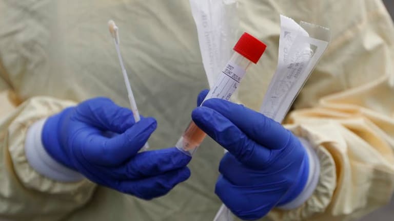 Making coronavirus testing easy, accurate and fast is critical to ending the pandemic – the US response is falling far short