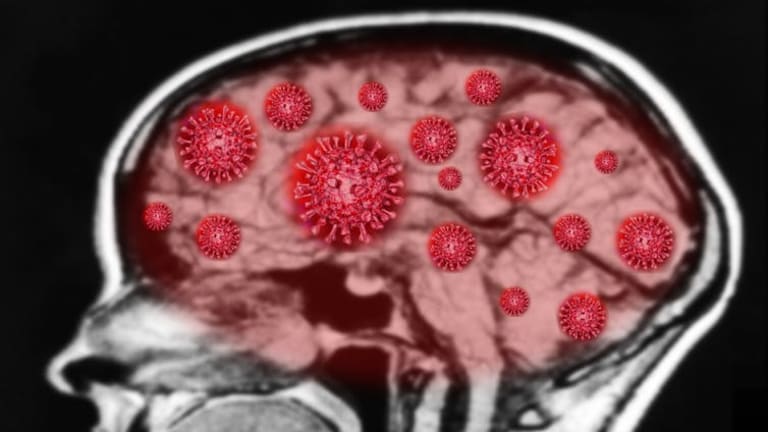 How COVID-19 might increase risk of memory loss and cognitive decline