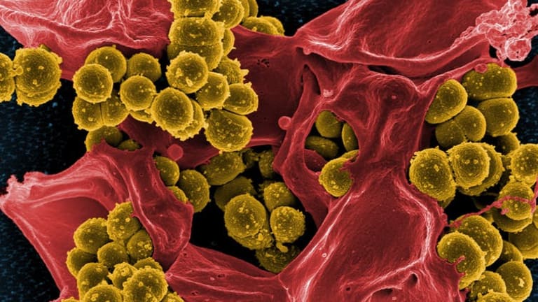 Deep learning AI discovers surprising new antibiotics