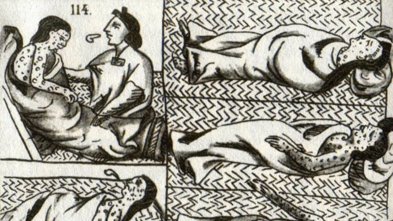 How smallpox devastated the Aztecs