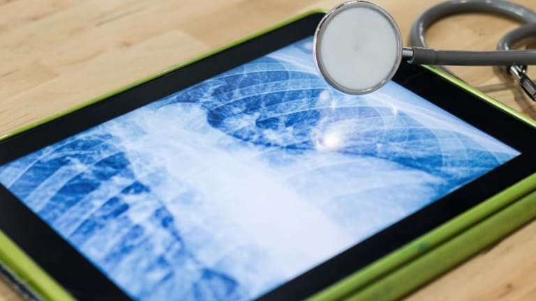 Your electronic health data: Understanding the different records, systems and...