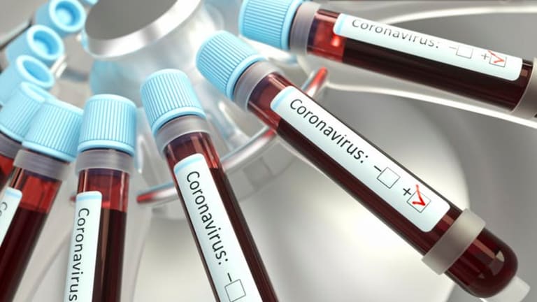 How coronavirus is upsetting the blood supply chain