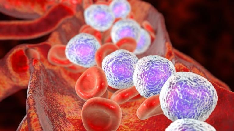 New DNA sequencing technique analyses tumours cell by cell to fight disease