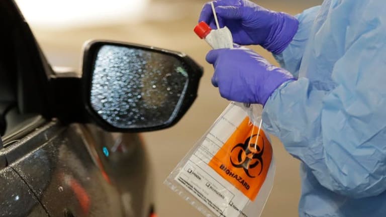 On the front lines of developing a test for the coronavirus