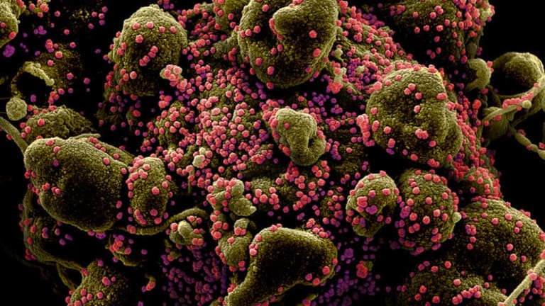 What the coronavirus does to your body that makes it so deadly