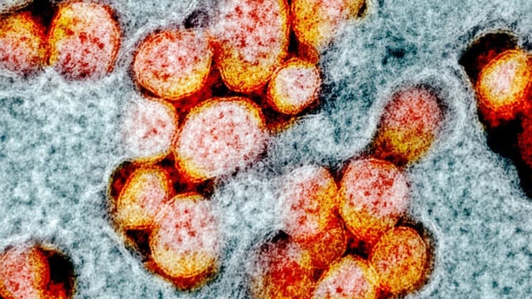 What we do and do not know about COVID-19′s infectivity and viral load