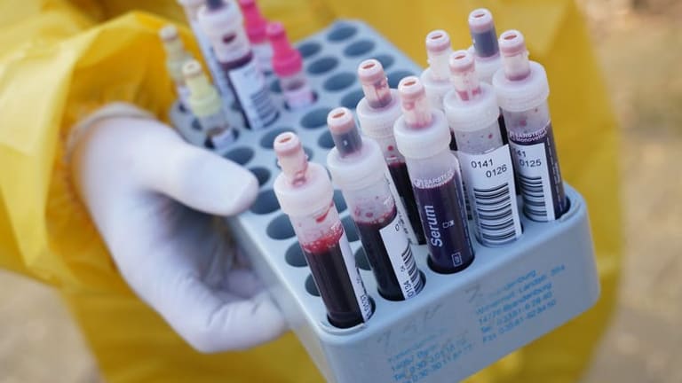 Checking blood for coronavirus antibodies – 3 questions answered about serological tests and immunity