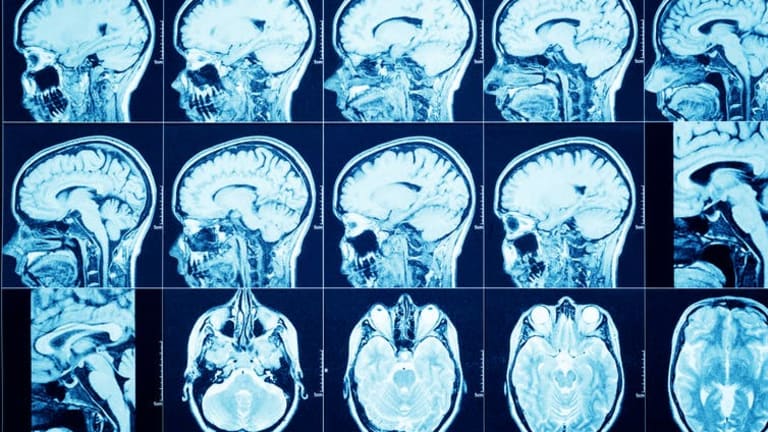 Coronavirus: many patients reporting neurological symptoms