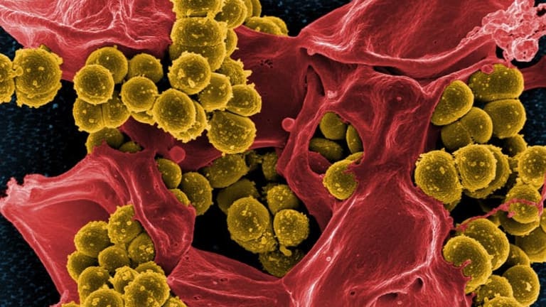 Drug-resistant superbugs: A global threat intensified by the fight against coronavirus