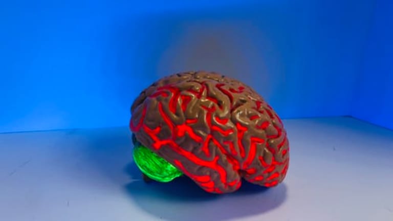 Reduce the Risk of Dementia and Diminished Capacity on Your Retirement Plan