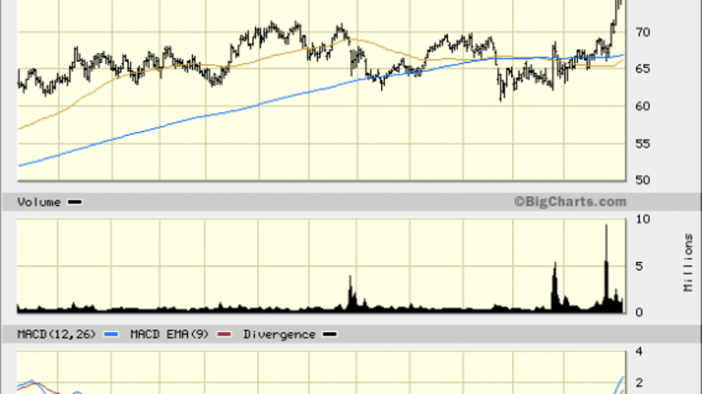 Steris (STE) Stock: Looking at a 20% Upside 
