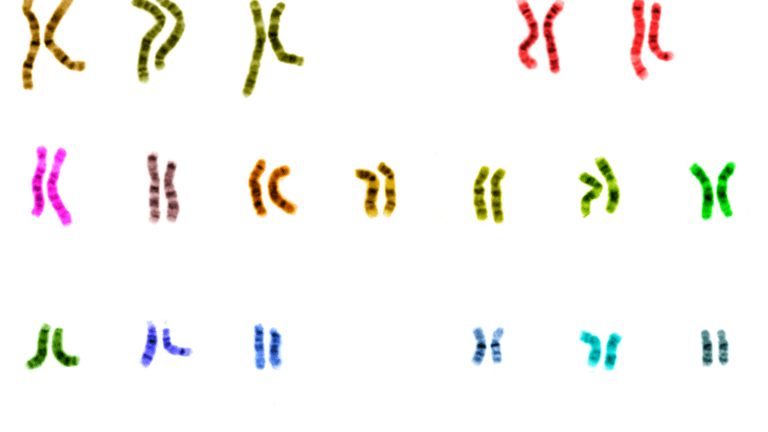 Scientists are on a path to sequencing 1 million human genomes and use big data to unlock genetic secrets
