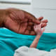 Daily deaths, world: 4,887Neonatal death is when a baby dies in the first 28 days after birth.