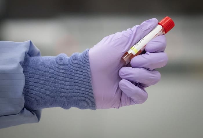A laboratory technical assistant at LifeLabs handles a specimen to be tested for COVID-19 after scanning its barcode upon receipt at the company’s lab, in Surrey, B.C., on March 26, 2020. THE CANADIAN PRESS/Darryl Dyck