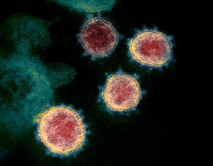 The immune system will usually generate an immune response to a SARS-CoV-2 infection, but not always. National Institutes of Allergy and Infectious Diseases, CC BY