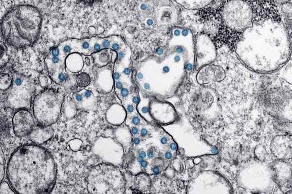 The coronavirus is simple biologically, but complicated in how it infects a host. CDC/ Hannah A Bullock; Azaibi Tamin