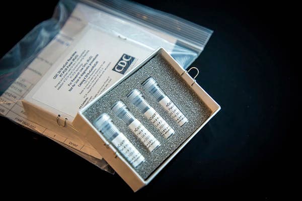 The Centers for Disease Control and Prevention decided to make its own coronavirus testing kit but the first release was flawed, one of a number of reasons for inadequate availability of testing in the early stages of the pandemic. CDC via AP