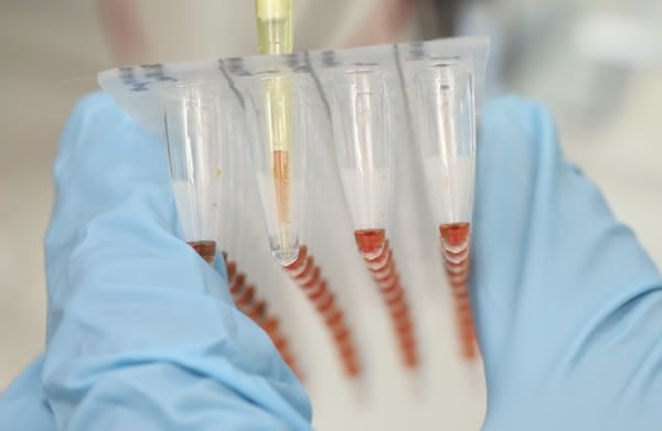 Researchers inserted engineered DNA into plant leaves to produce antibodies to fight the Ebola virus. Sean Gallup/Getty Images News via Getty Images Europe