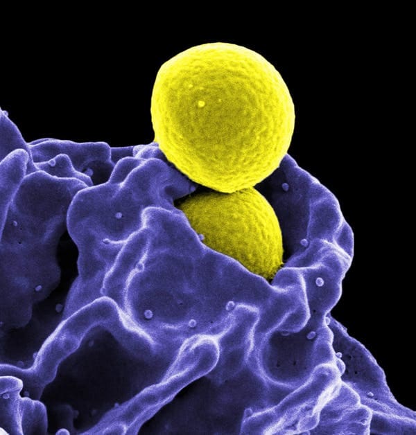 Two methicillin-resistant Staphylococcus aureus (MRSA) bacteria, being enveloped by a white blood cell. (NIAID)