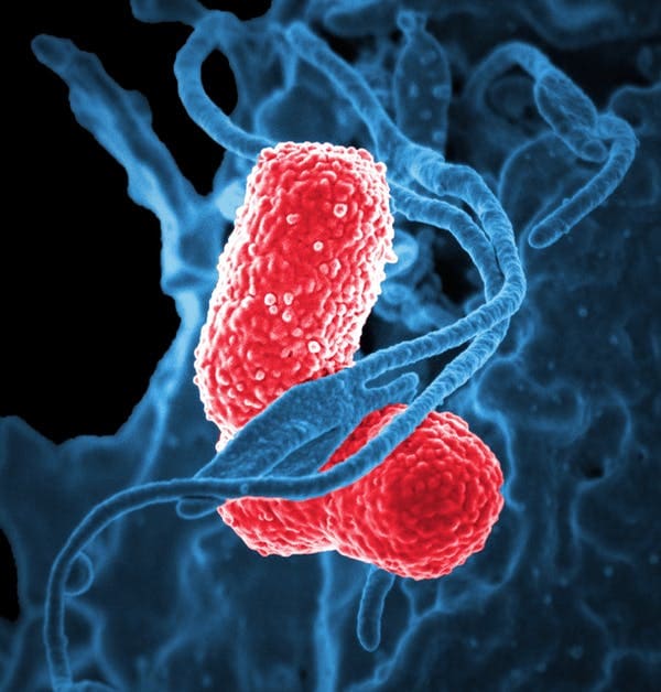 Multidrug-resistant Klebsiella pneumoniae bacteria, which are known to cause severe hospital acquired nosocomial infections. (David Dorward/NIAID)