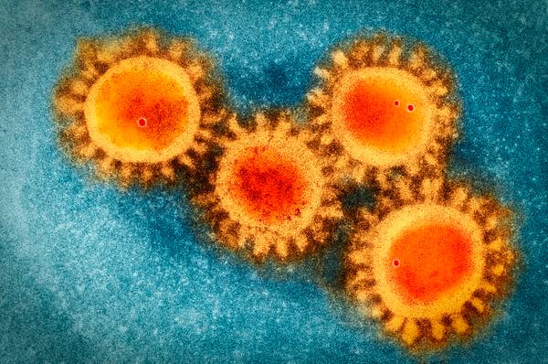 The coronavirus attacks human cells using dozens of devious tricks. narvikk/iStock Getty Images Plus via Getty Images