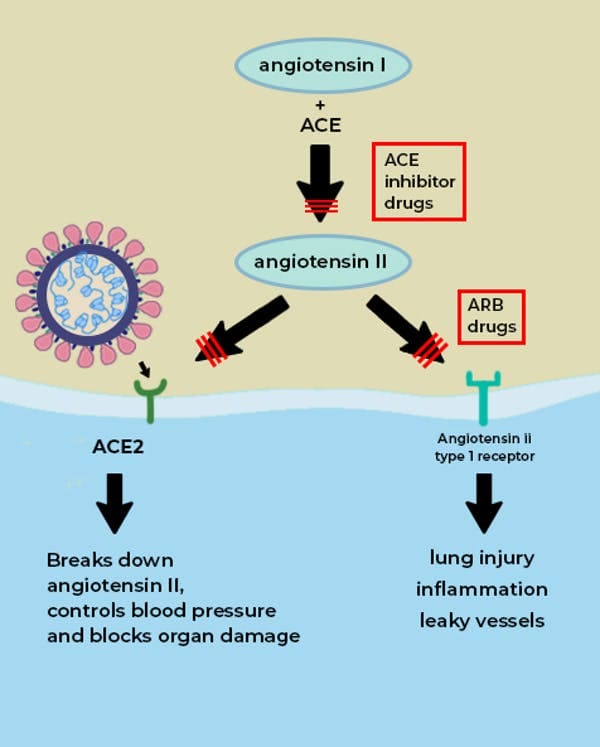 The ACE enzyme converts angiotensin I into angiotensin II. The main role of ACE2 is to break down angiotensin II into molecules that counteract angiotensin II’s harmful effects; but if the virus occupies the ACE2 ‘receptor’ on the surface of cells, then its role is blunted (red lines). Drugs called ACE inhibitors inhibit the formation of angiotensin II, which would otherwise interact with the angiotensin type 1 receptor to produce tissue damage and inflammation. Drugs called ARBs block angiotensin II from interacting with its receptor. Figure adapted from NEJM The Conversation, CC BY-SA