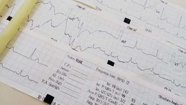 All AI relies on data – in this case, the medical history of 53 COVID-19 patients in China. Siriporn Kingkaew/EyeEm via Getty Images