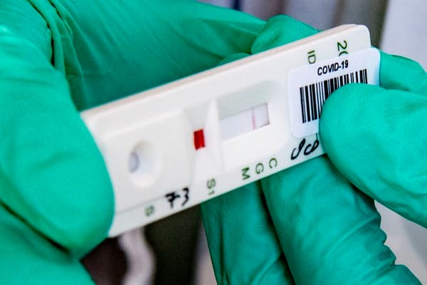 In the Netherlands, this strip tests blood samples for antibodies against the coronavirus. Right now the test costs 70 euros. Robin Utretcht/SOPA Images/LightRocket via Getty Images, CC BY-SA