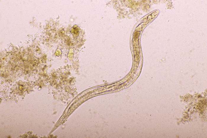 Ivermectin has been used to treat strongyloidiasis, an intestinal infection that can be life-threatening for the immunocompromised. jarun011/iStock via Getty Images Plus