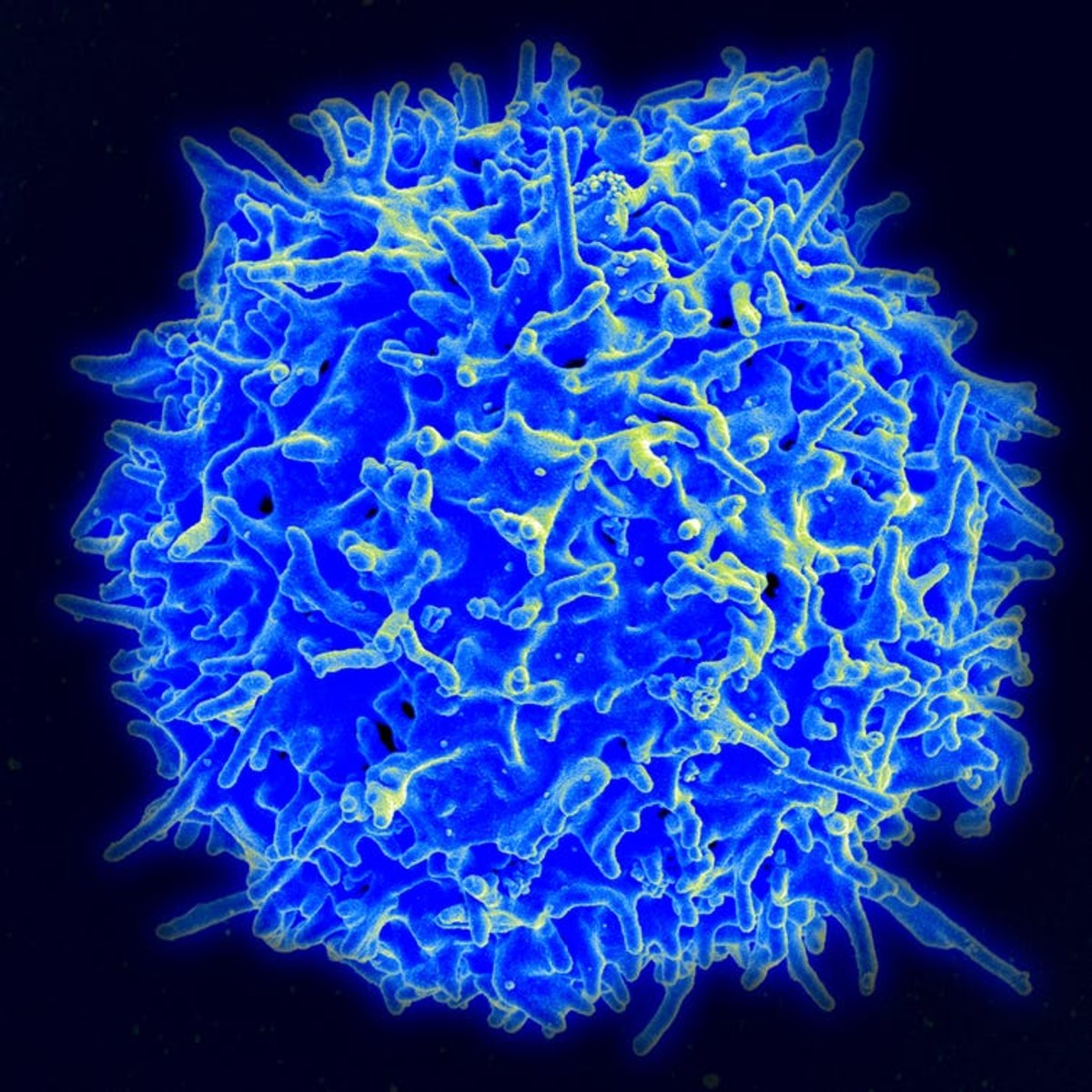 COVID–19 vaccines produce a strong immune response in terms of both antibodies and T cells, like the T cell in this photo. National Institutes of Allergy and Infectious Diseases/National Institutes of Health