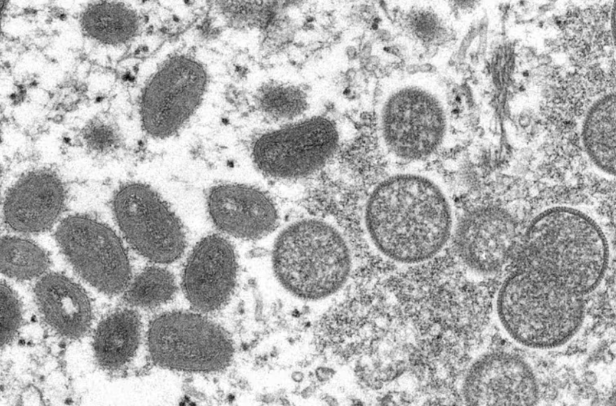 Monkeypox belongs to the Poxviridae family of viruses, which includes smallpox. CDC/ Cynthia S. Goldsmith